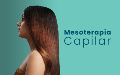 Mesoterapia Capilar