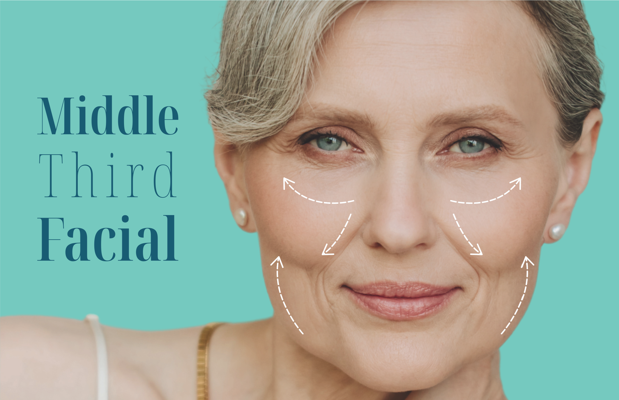 Middle Third Facial ENGLISH Dr Paola Gordillo